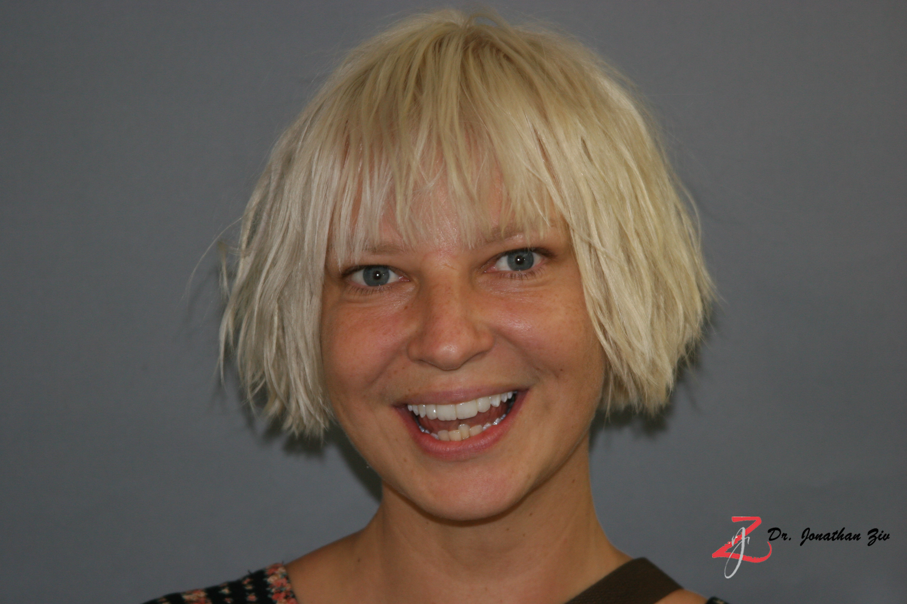 Download this Sia Furler picture
